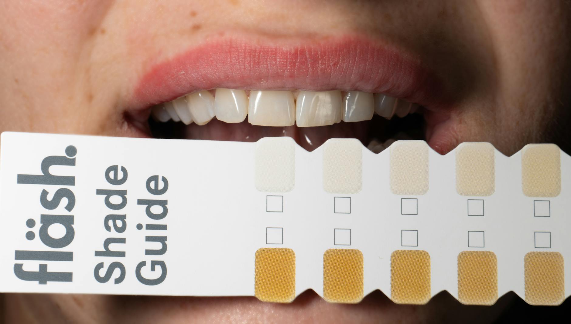 Carillas vs blanqueamiento dental — qué es mejor para ti