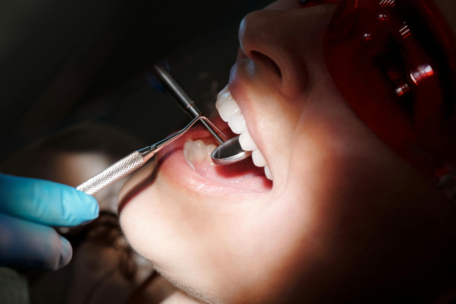 Duración y mantenimiento de carillas dentales — guía completa